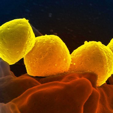 illustration de la bactérie streptocoque du groupe A ©(NIAID) au Canada, CC BY